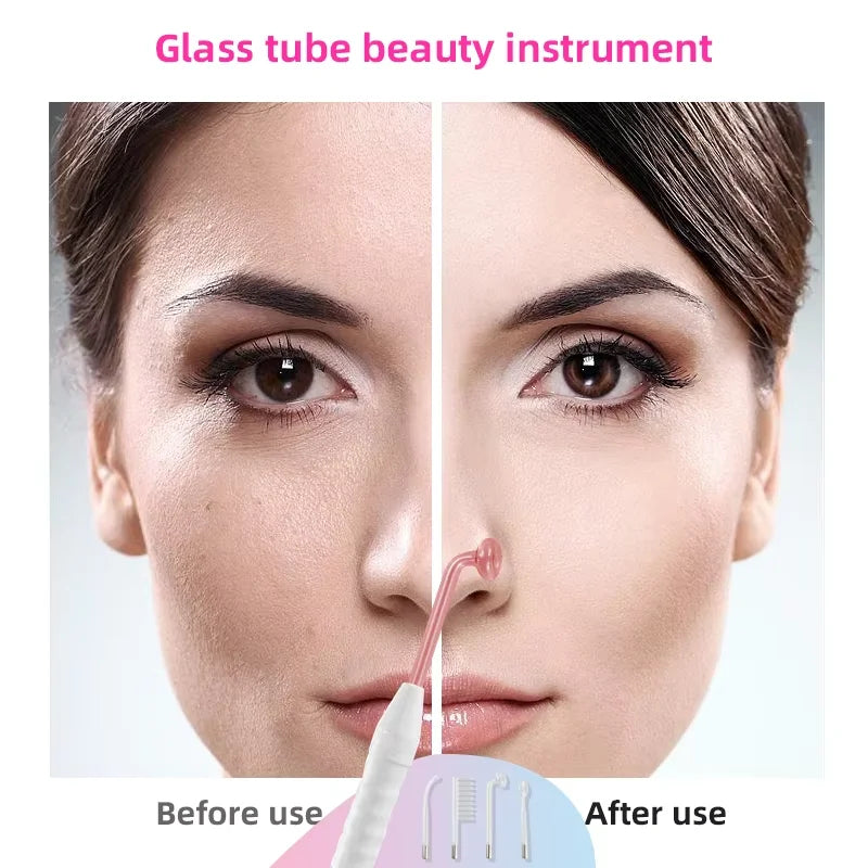 SkinPen Professional - 4 in 1 High Frequency Device - Facial and Anti-Imperfections Treatment