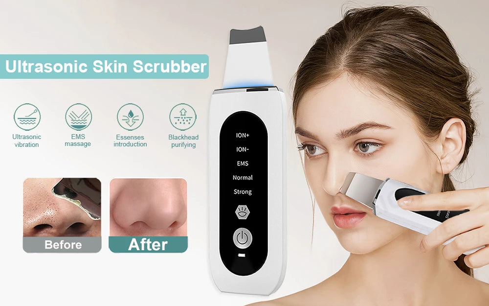 Ultrasonic Facial Cleansing Device – 5 Modes, Red & Blue LED, Exfoliation and Lifting