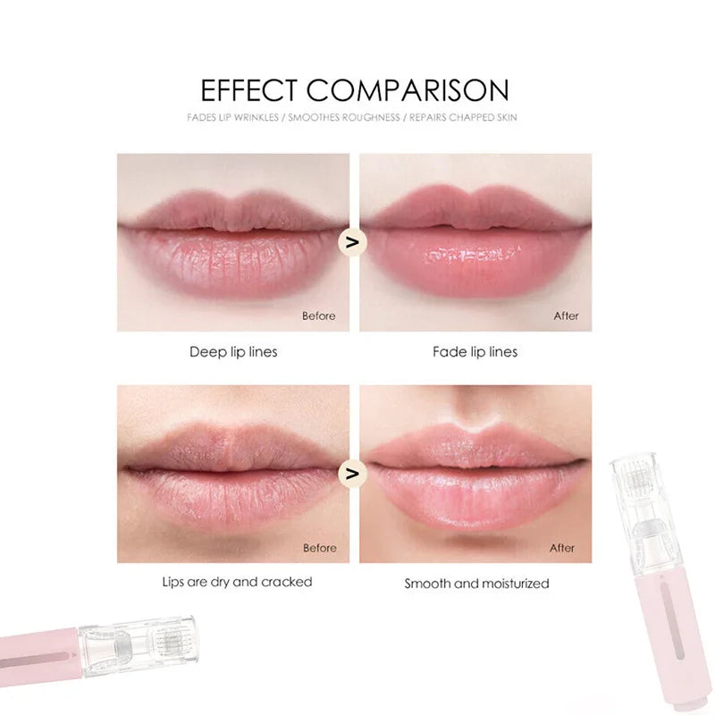 Derma Roller Titanium: Cuidado labial específico, estimulación y aplicador de sérum