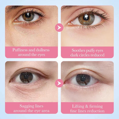 Masque Yeux au Collagène Sakura – Anti-Cernes, Anti-Poches & Hydratation