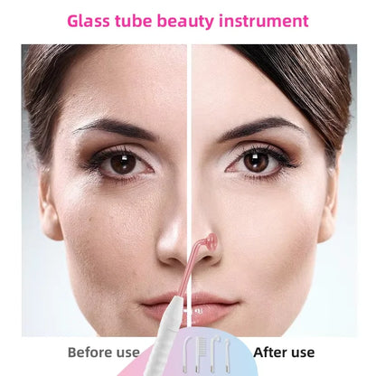 SkinPen Professional - 4 in 1 High Frequency Device - Facial and Anti-Imperfections Treatment