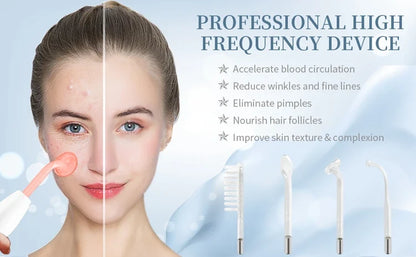 SkinPen Professional - 4 in 1 High Frequency Device - Facial and Anti-Imperfections Treatment