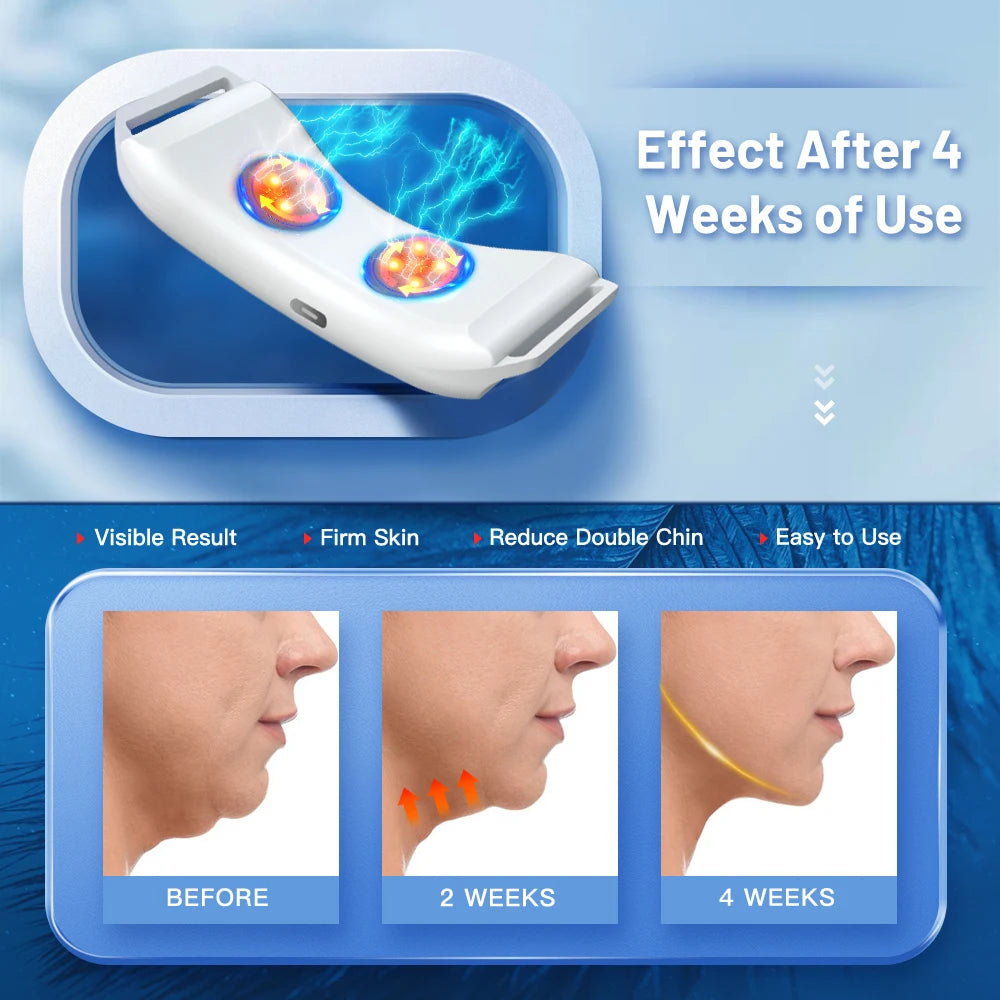 V-Line Face Firming Device – EMS Double Chin | Heated or Standard Model