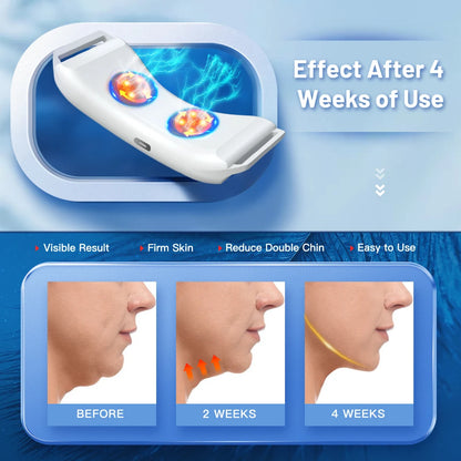 V-Line Face Firming Device – EMS Double Chin | Heated or Standard Model