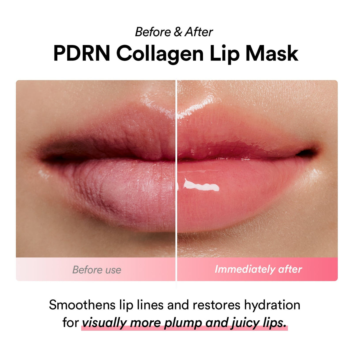 Abib PDRN Collagen Lip Mask Glazed Jelly – Masque lèvres PDRN et collagène 11 ml